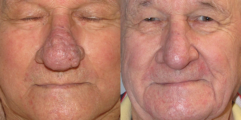 Before & After Image Before & After Image