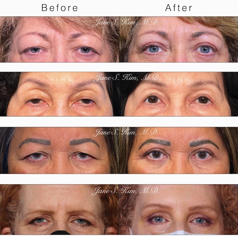 1764028204_July-AC-eye-graphic-1-1