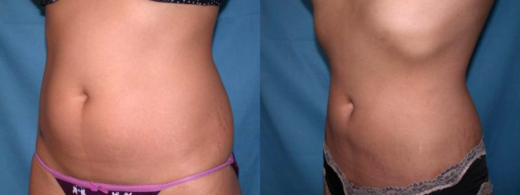 Before & After Image Before & After Image