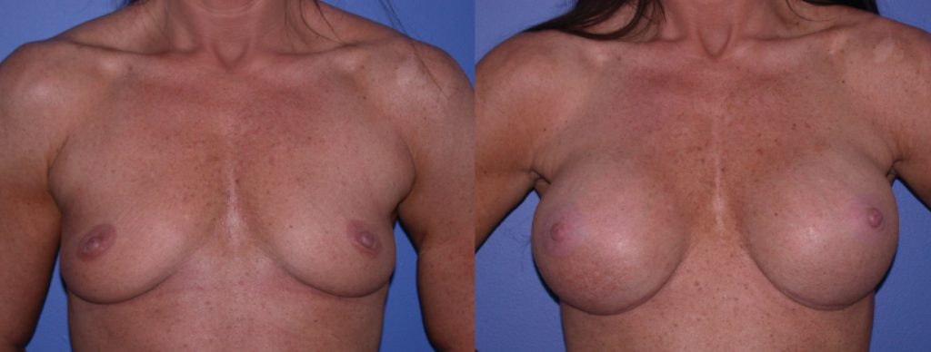 Before & After Image Before & After Image