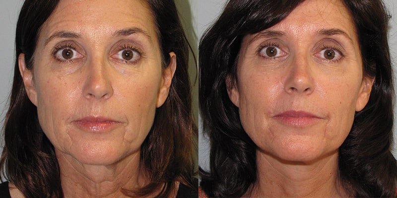 Before & After Image