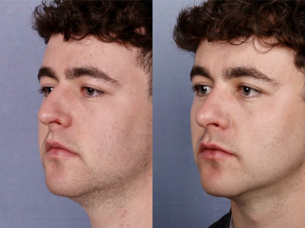 Before & After Image Before & After Image