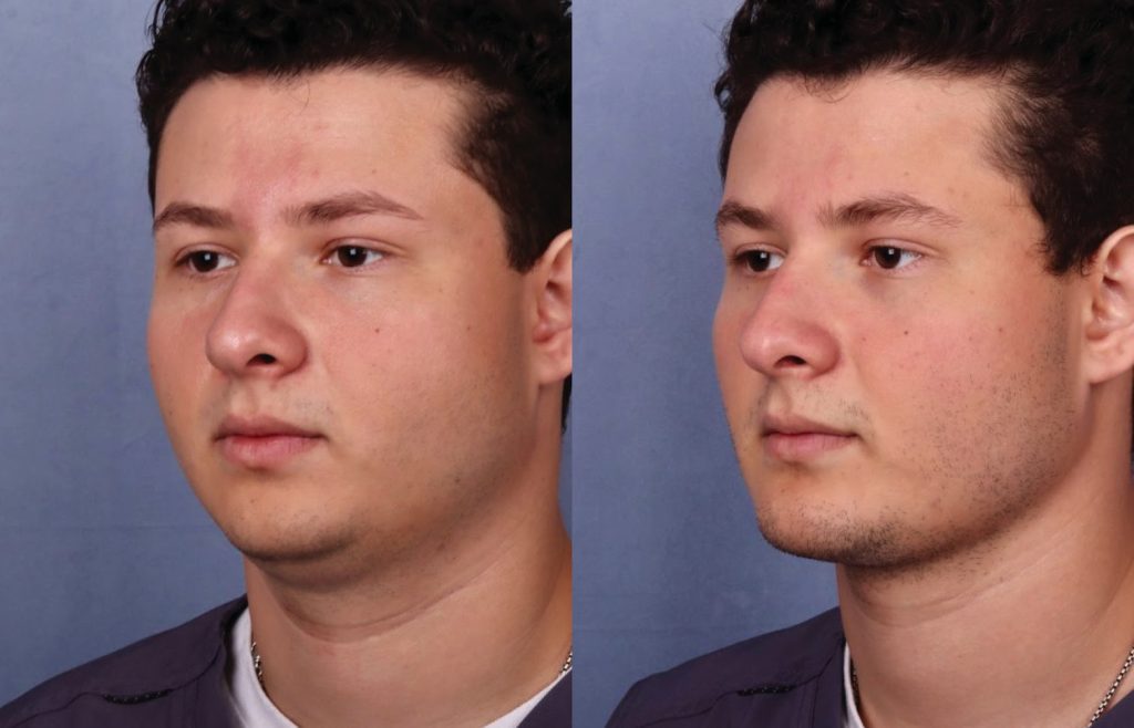 Before & After Image