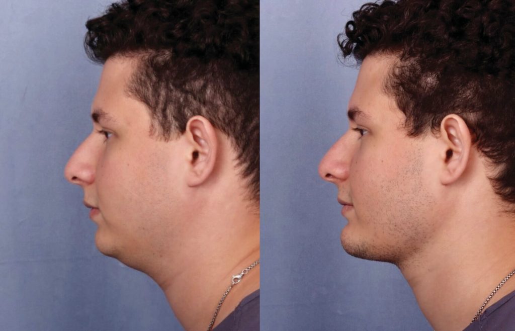 Before & After Image