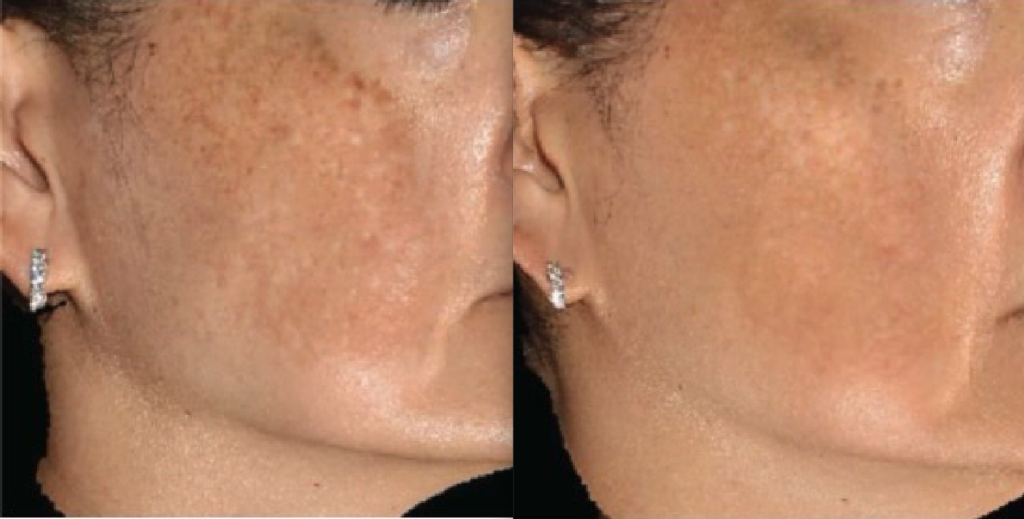 Before & After Images Before & After Images