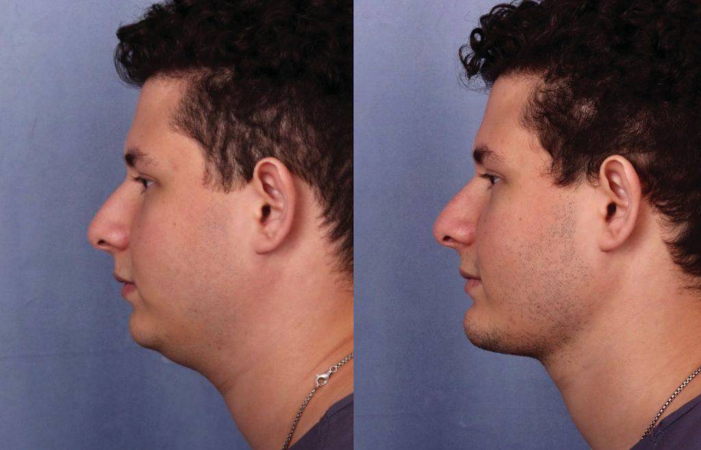 Before & After Image Before & After Image