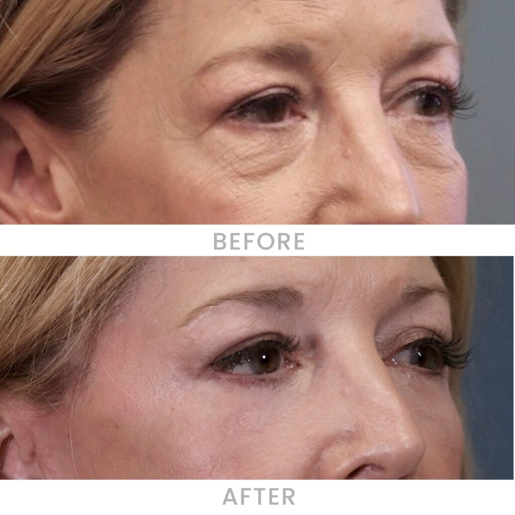 Before & After Images Before & After Images