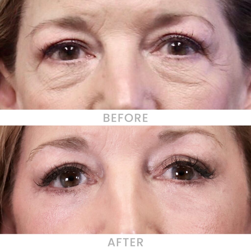 Before & After Images Before & After Images