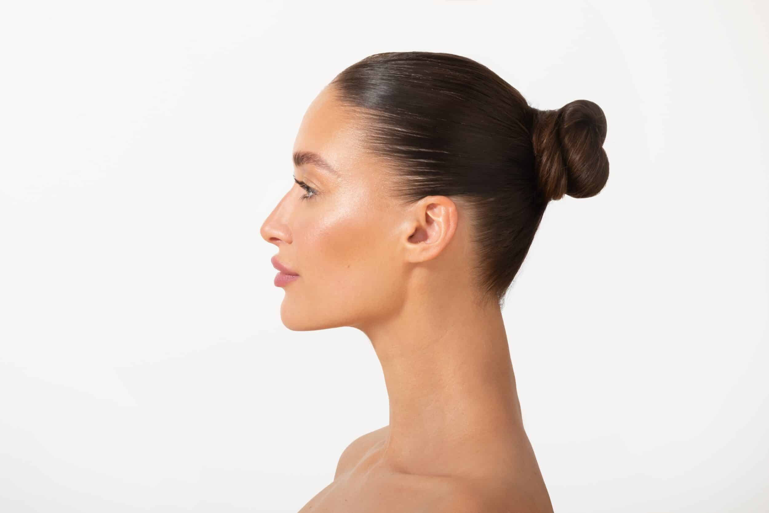 Side profile of woman after revision rhinoplasty in Newport Beach, CA